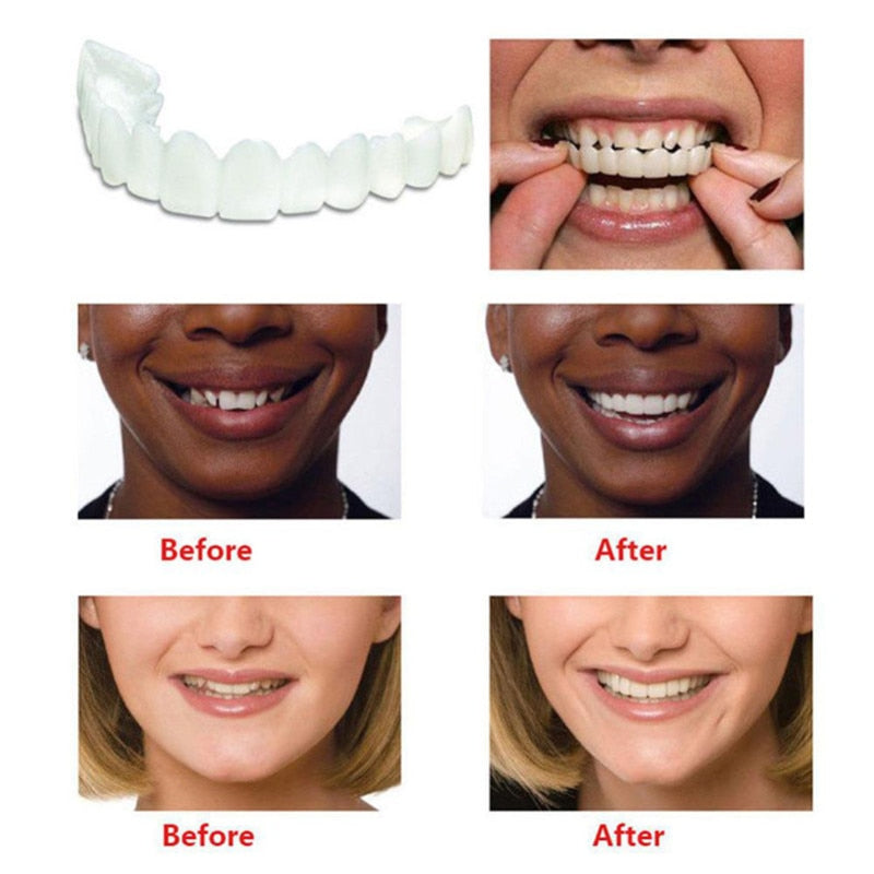 Whitening Snap on Smile Perfect