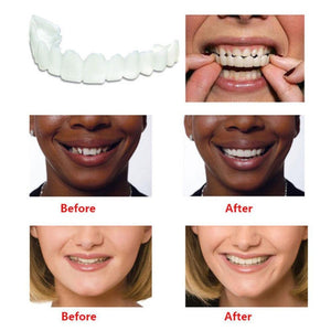 Whitening Snap on Smile Perfect